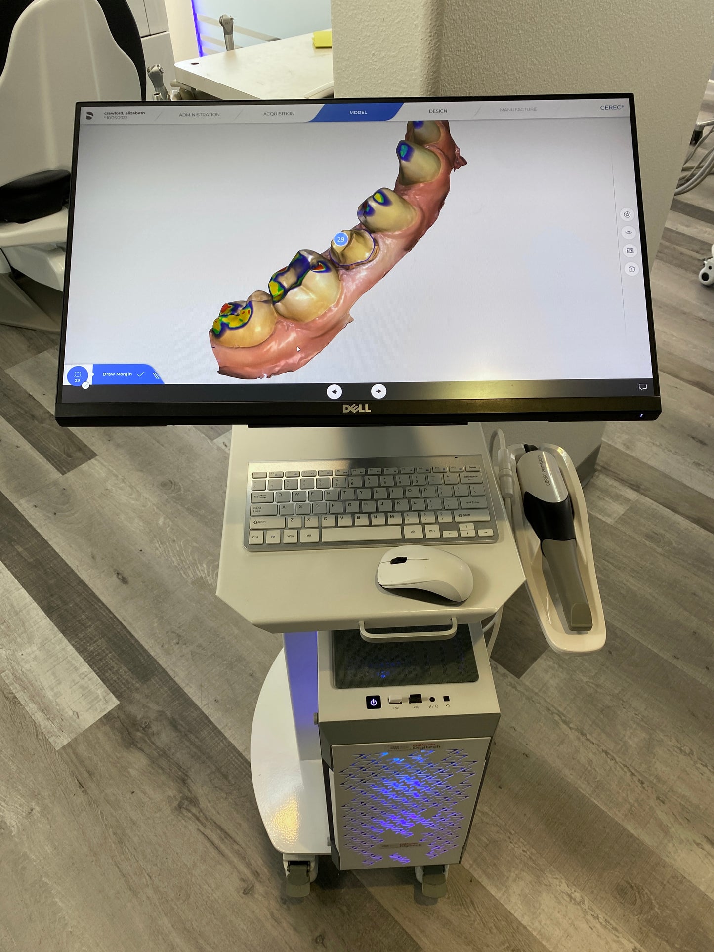 Cerec Primescan 5.2 (INTEL i9) Unlocked CUSTOMIZED